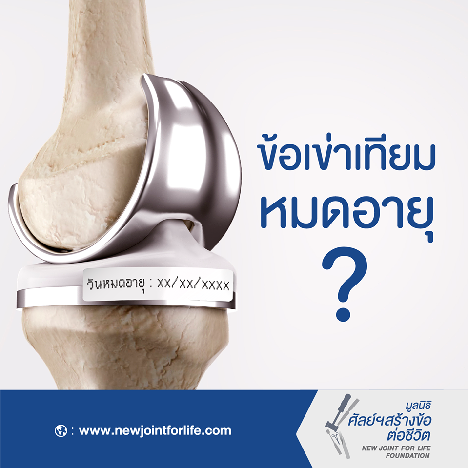 ข้อเข่าเทียมหมดอายุ