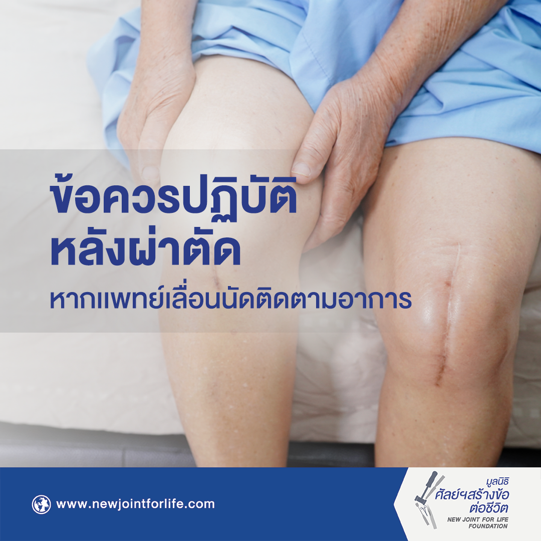 ข้อควร ปก