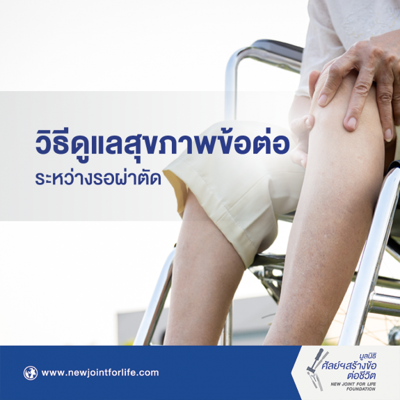 วิธีการดูแล ปก